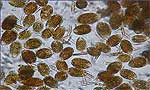 Ostreopsis Ovata под микроскопом