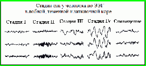 Стадии сна